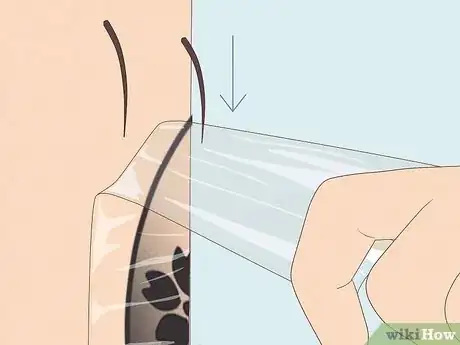 Image titled Remove Saniderm Step 4