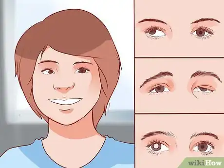 Image titled Get Rid of a Lazy Eye Step 1