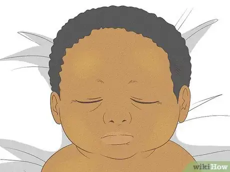 Image titled Know What to Expect on a Newborn's Skin Step 15