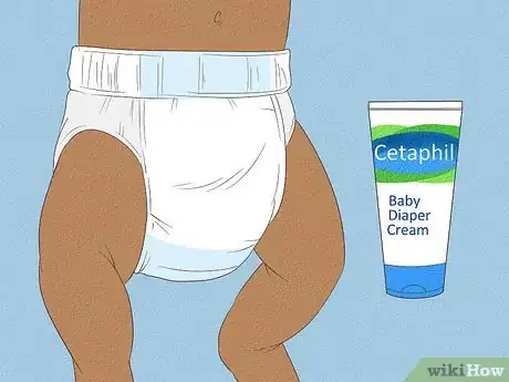 Image titled Know What to Expect on a Newborn's Skin Step 14