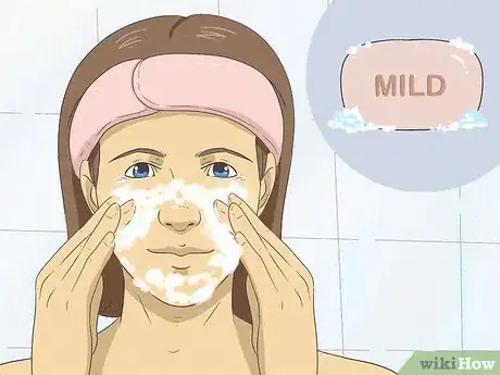 Image titled Heal Your Face After Picking Step 1