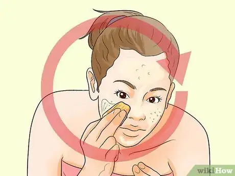 Image titled Treat Acne With Banana Peels Step 6