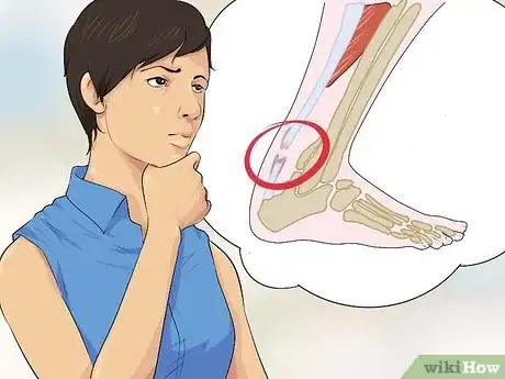 Image titled Diagnose a Torn Calf Muscle Step 13