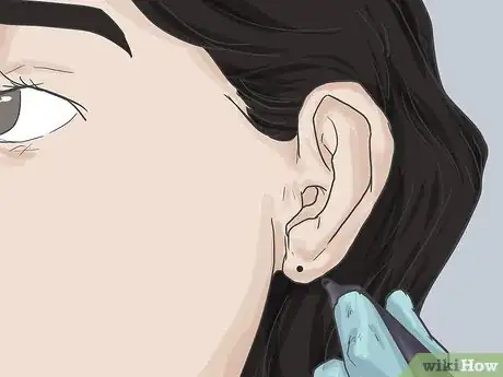 Image titled Pierce Your Ear with a Safety Pin Step 5