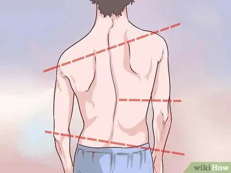 Image titled Diagnose Adult Scoliosis Step 1