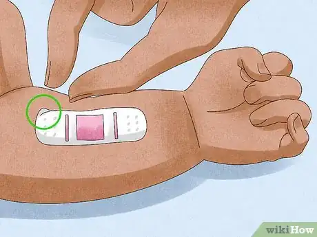 Image titled Remove a Bandage from a Baby Step 5