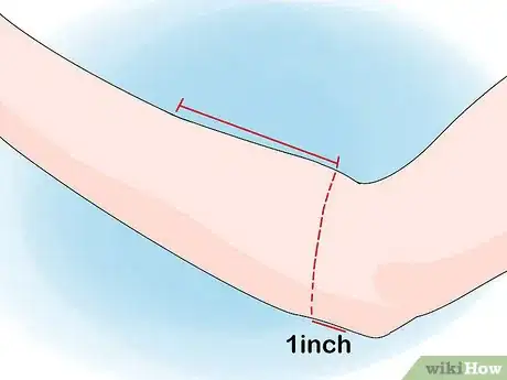 Image titled Wear a Tennis Elbow Brace Step 2