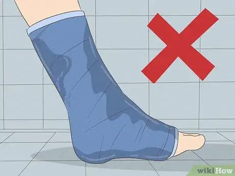Image titled Treat a Broken Ankle Step 20