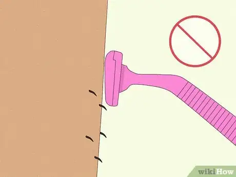 Image titled Prevent Ingrown Hairs After Waxing Using Home Remedies Step 10