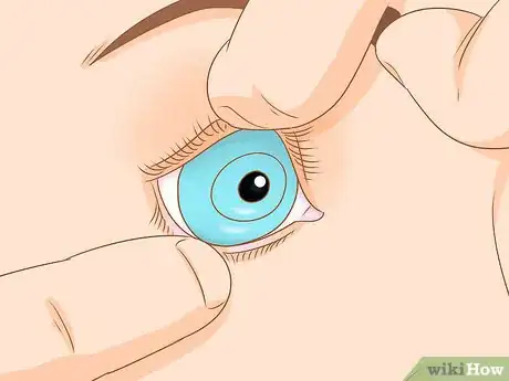 Image titled Insert and Remove a Scleral Lens Step 11