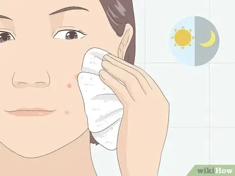 Image titled Treat Acne With Ice Step 3