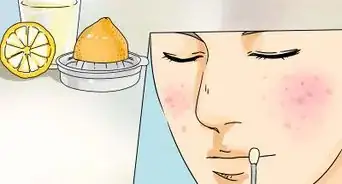 Stop or Cure Pimples
