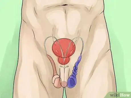 Image titled Deal with Testicular Pain Step 8