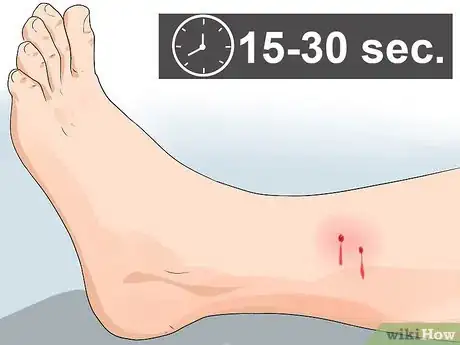 Image titled Apply a Pressure Bandage Step 15