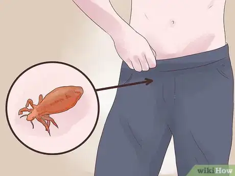 Image titled Recognize Crabs Step 4