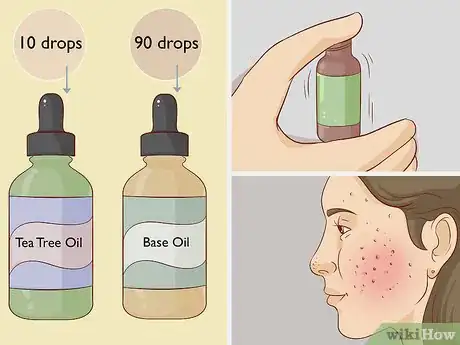 Image titled Use Oils on Your Face Step 9