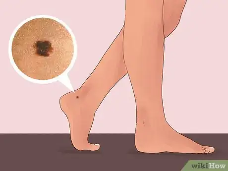 Image titled Have Flawless Feet Step 9