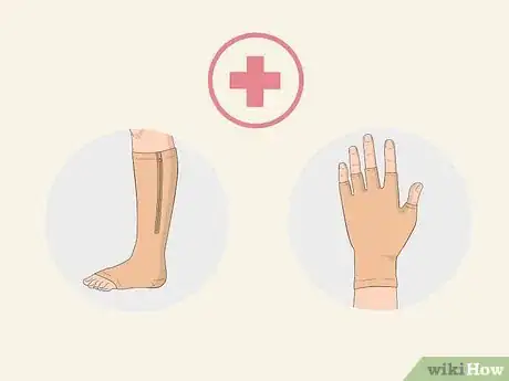 Image titled Dry Up Edema Blisters Step 10