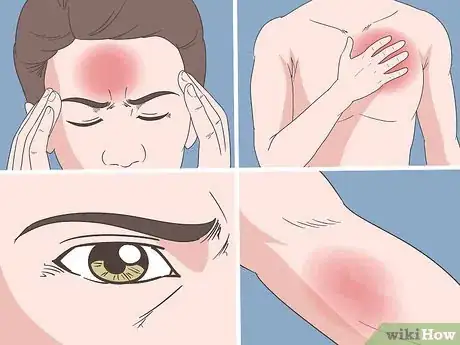 Image titled Get Rid of a Headache Naturally Step 19