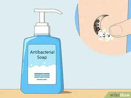 Image titled Remove Saniderm Step 5