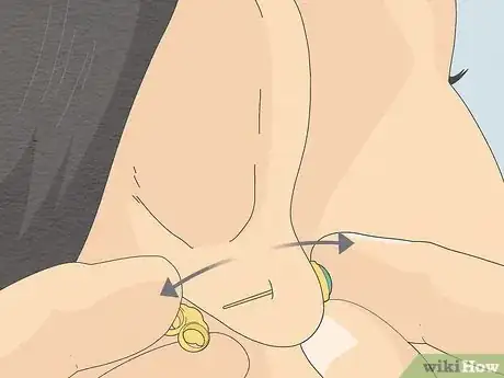 Image titled Clean Your Ear Piercing Step 8