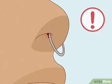 Image titled Why Does My Septum Piercing Smell Step 9