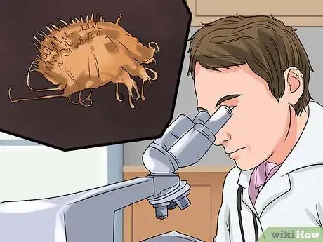Image titled Diagnose Scabies Step 1
