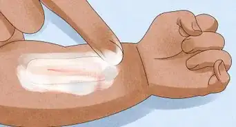 Remove a Bandage from a Baby