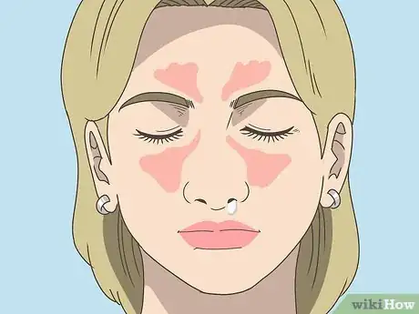 Image titled Get Rid of a Sinus Infection Without Antibiotics Step 28