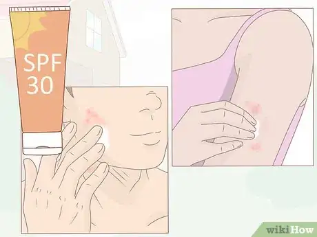 Image titled Take Care of Your Skin While on Accutane Step 12