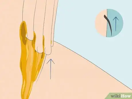 Image titled Give Yourself a Brazilian Wax Step 11