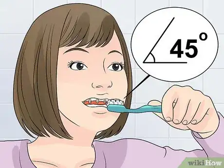 Image titled Whiten Your Teeth when You Have Braces Step 2