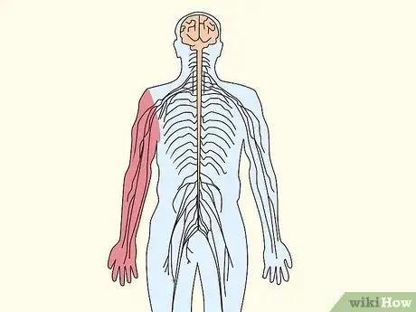 Image titled Diagnose Chronic Inflammatory Demyelinating Polyneuropathy (CIDP) Step 13