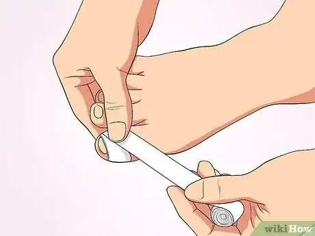 Image titled Tell if an Ingrown Toenail Is Infected Step 6