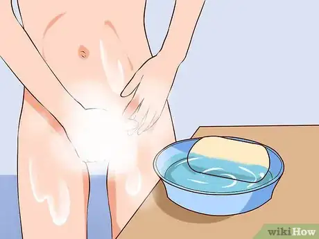 Image titled Insert Vaginal Suppositories Step 1