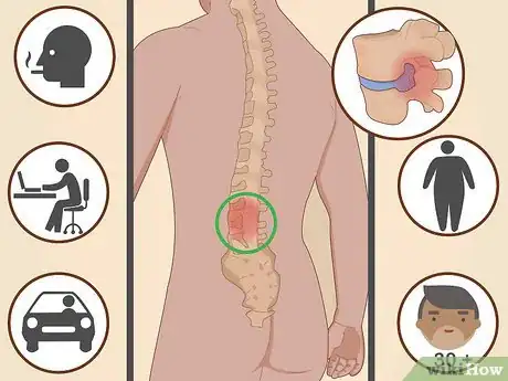 Image titled Diagnose a Herniated Disc Step 5