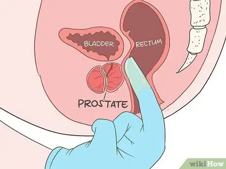 Image titled Locate Your Prostate Step 9