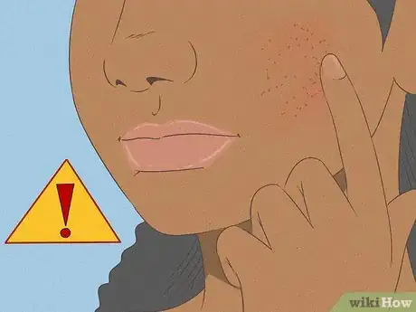 Image titled Remove Dead Skin Using Sugar Step 9