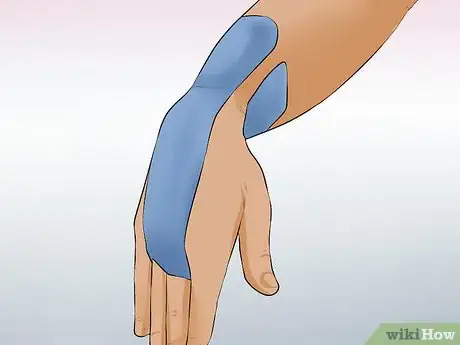 Image titled Wrap a Wrist for Carpal Tunnel Step 5