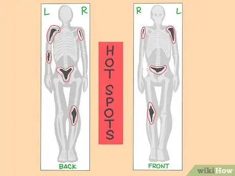 Image titled Understand the Results of a Bone Scan Step 5