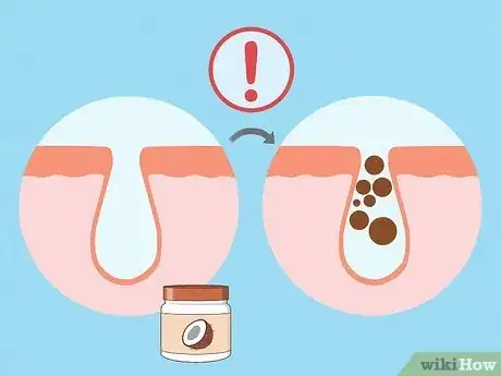 Image titled Use Coconut Oil for Acne Step 13