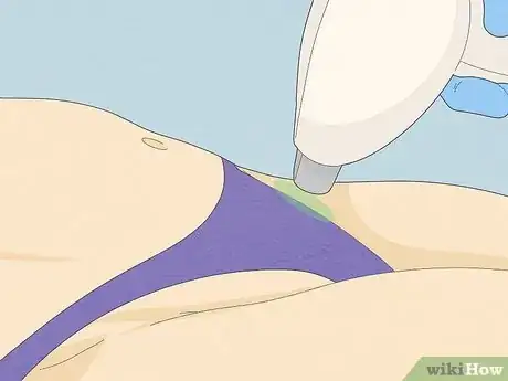 Image titled Get Rid of Razor Bumps in the Bikini Area Step 17