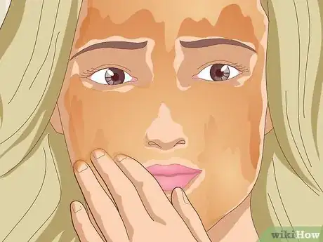 Image titled Reduce Oil from Your Face Naturally Step 8