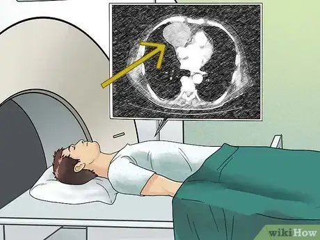 Image titled Diagnose a Thymoma Step 14