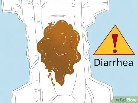 Image titled Tell if Your Newborn Has Diarrhea Step 3