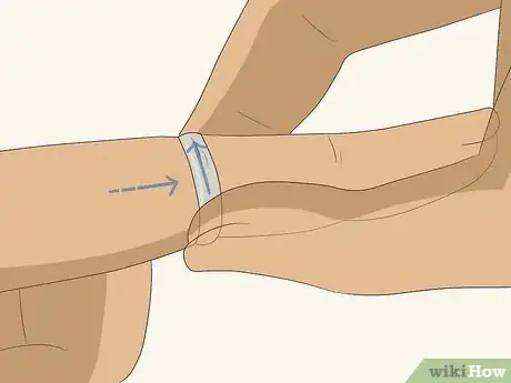 Image titled Remove a Ring in an Emergency Step 5