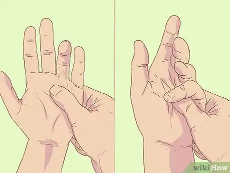 Image titled Diagnose Dupuytren's Contracture Step 11