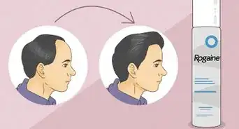 Prevent Hair Loss