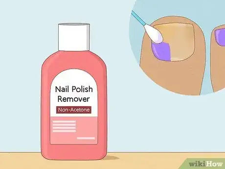 Image titled Get Rid of Yellow Toenails Step 7