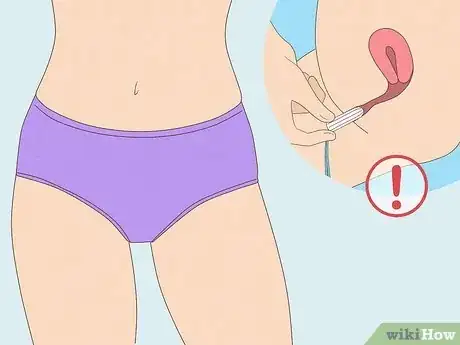 Image titled How Does Period Underwear Work Step 4